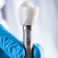 Implant Treatment Process, Benefits, and Care